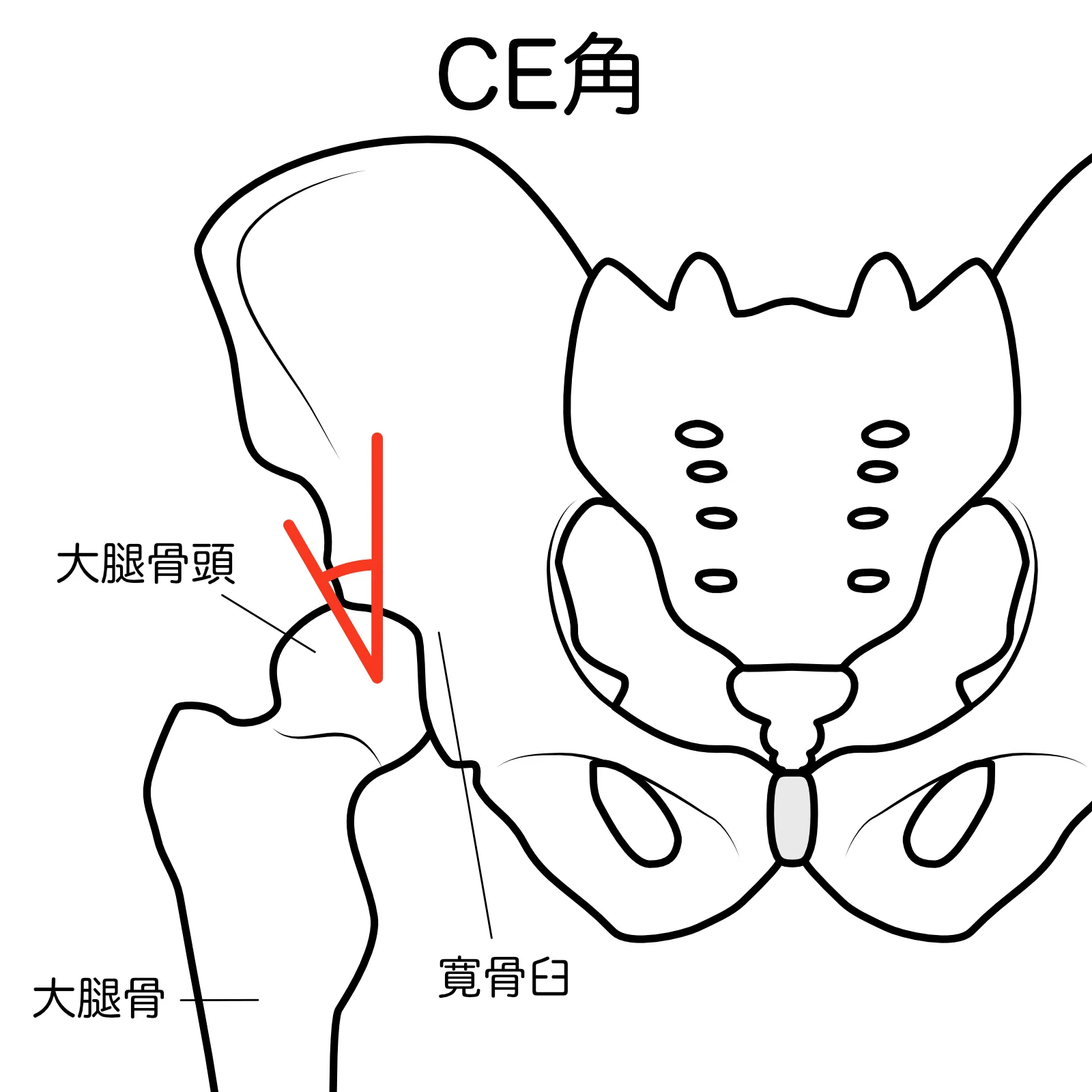股関節のCE角を示す図解